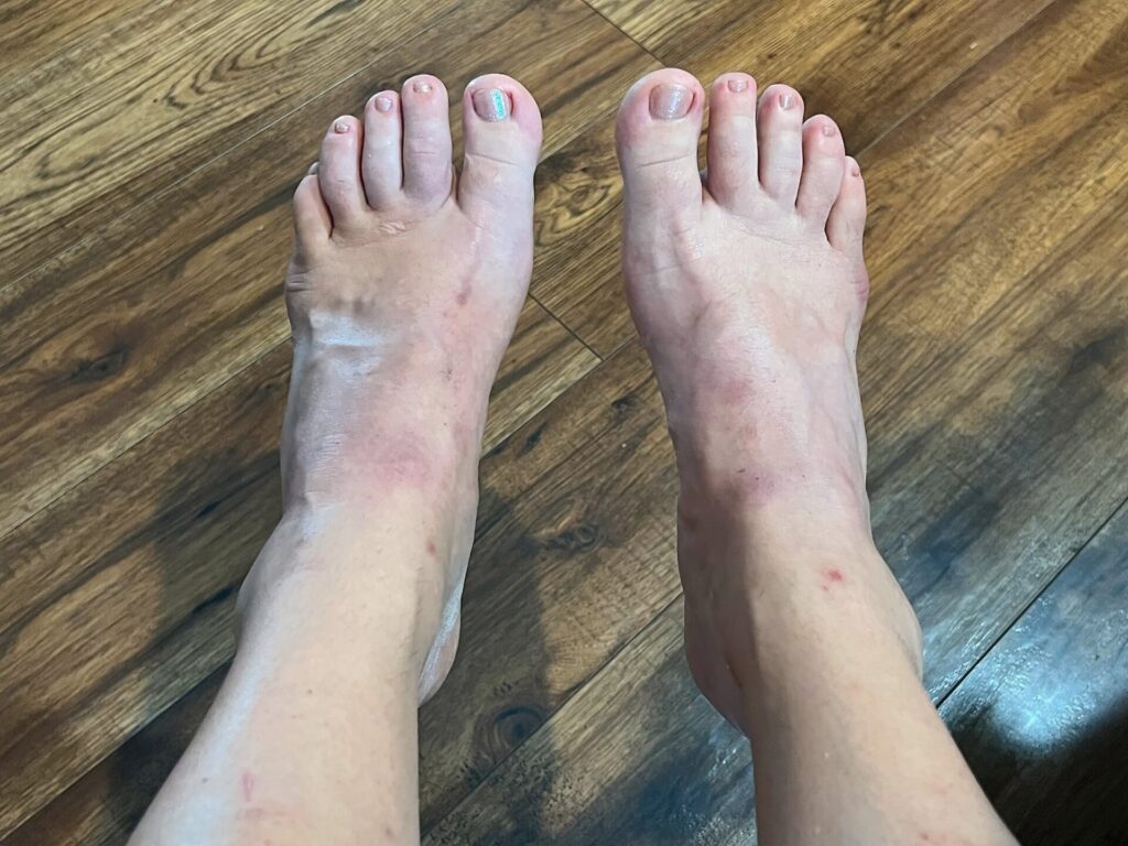 Appalachian Trail feet